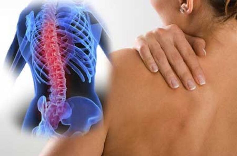 Con l'osteocondrosi, il dolore può irradiarsi in parti distanti del corpo