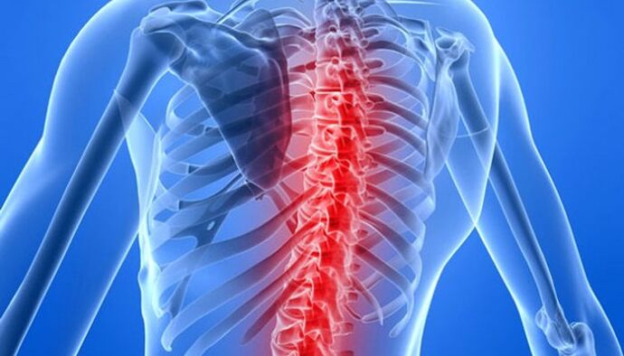Le patologie spinali sono le cause più comuni di mal di schiena nella zona della scapola