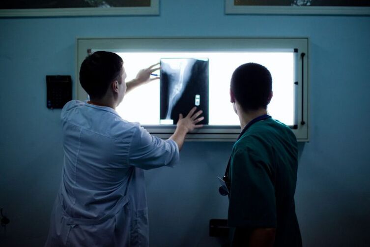 Diagnosi di artrosi sul raggio x