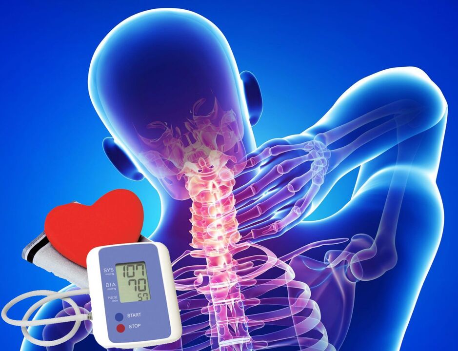 Salti della pressione sanguigna con osteocondrosi cervicale